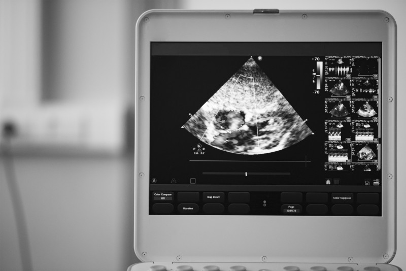 Advantages of Having a Diagnostic Ultrasound for Musculoskeletal Issues