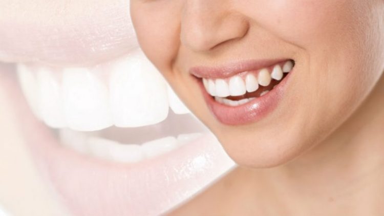 Visit A Cosmetic Dentist In Atlanta For All Your Dental Needs