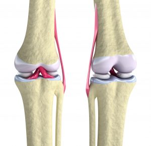 Exploring Some Support Options as Joint Pain Treatment in Dayton, OH